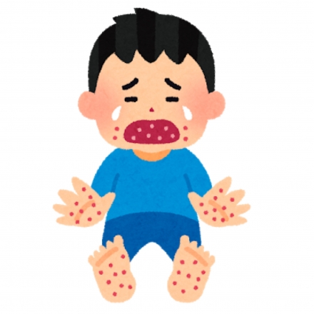 手足口病